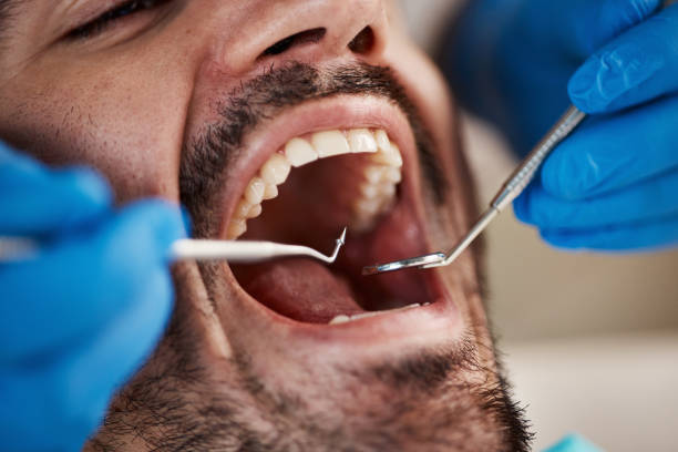 Best Emergency Dental Services Near Me  in Milford Square, PA